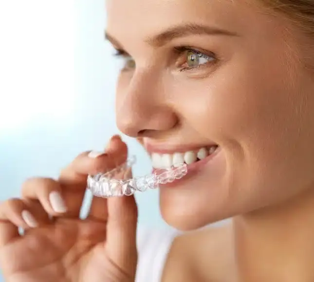 Woman inserting clear aligner tray for teeth straightening treatment